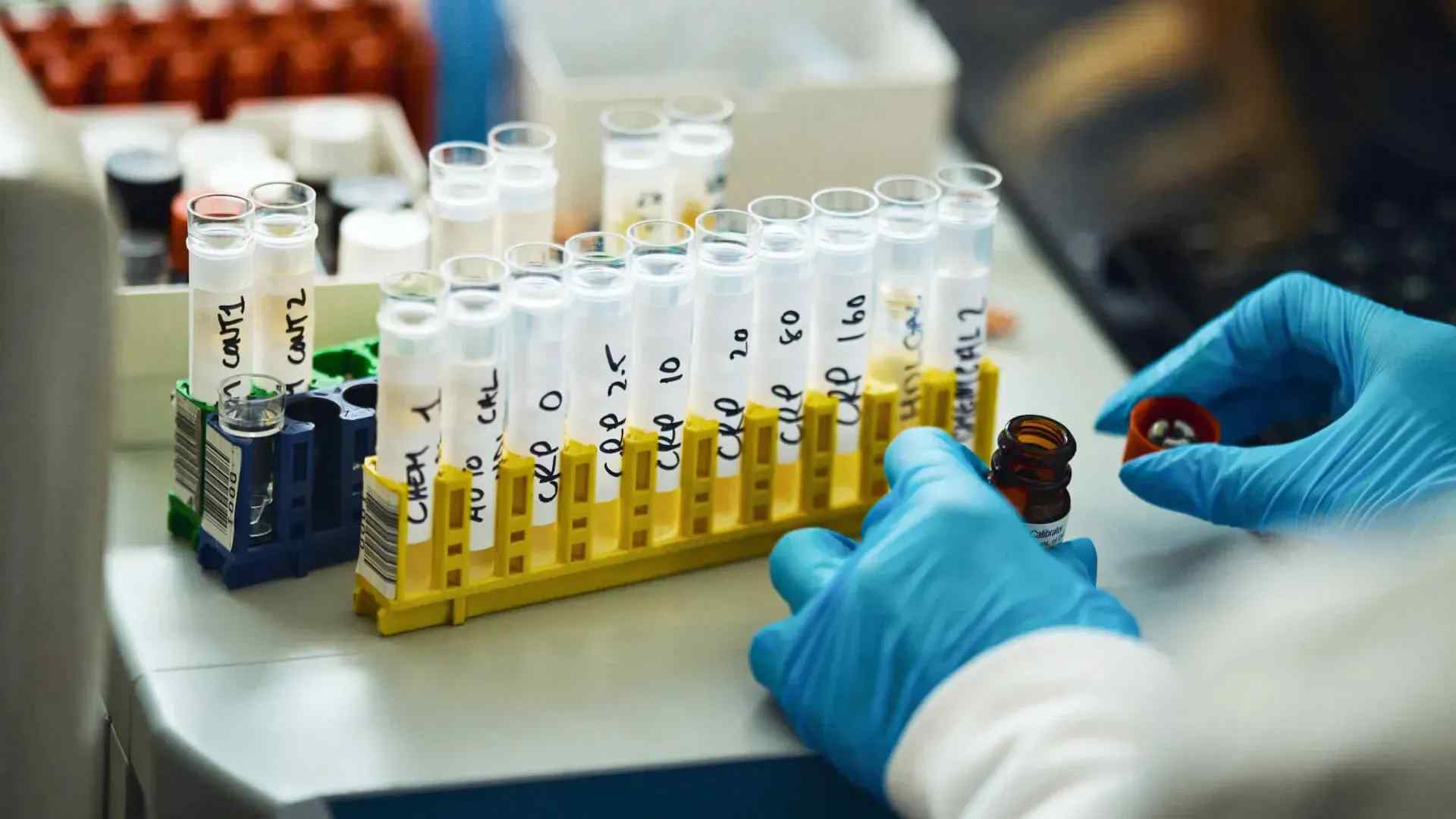 test tubes